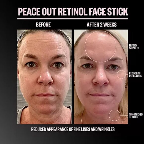 Peace Out Retinol Face Stick - NIB - Picture 7 of 7